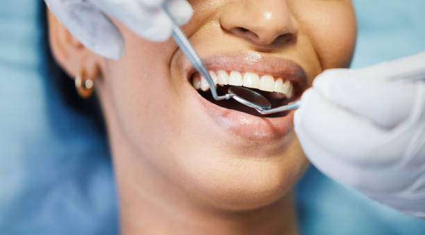 Best Emergency Treatment for Toothache in Chehalis, WA